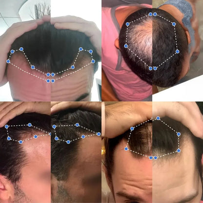 Bodywise – Serum De Crecimiento Capilar y Barba