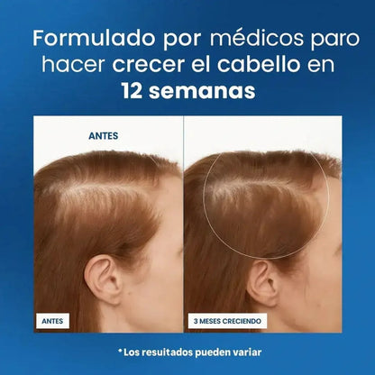 Bodywise – Serum De Crecimiento Capilar y Barba